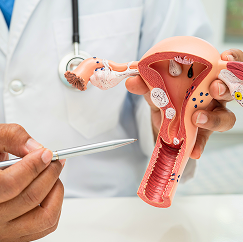 Gynecology